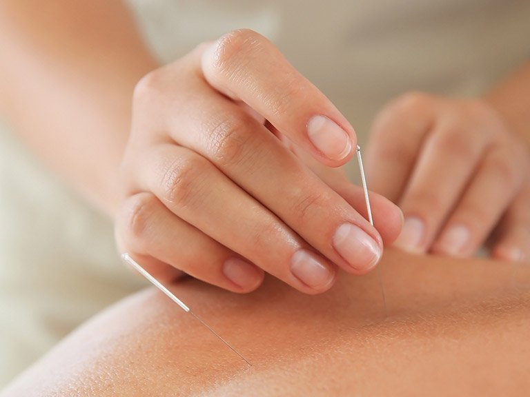 Akupunktur und Massage bei krebsbedingten Schmerzen