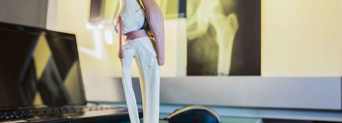 Carstens-Stiftung: Schmerz(mittel)-Reduktion nach Kniegelenksersatz mit nicht-medikamentösen Begleittherapien