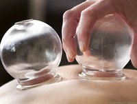 Carstens-Stiftung: Schröpfen