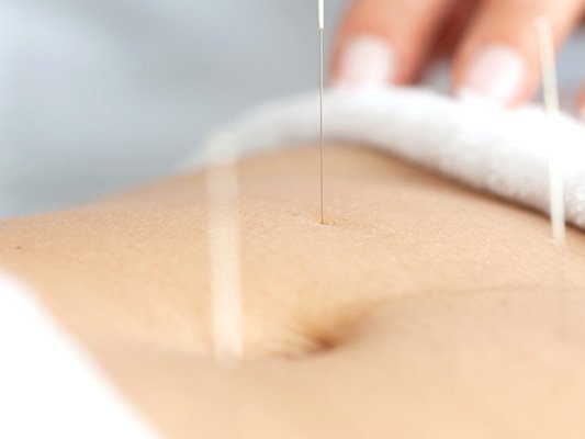 Akupunktur zur Schmerzlinderung nach Operationen