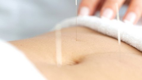 Akupunktur zur Schmerzlinderung nach Operationen