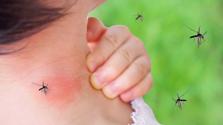 Hitze, Insekten, Sonne – diese zehn Heilpflanzen helfen Hitze, Insekten, Sonne – diese zehn Heilpflanzen helfen