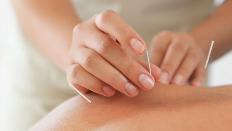 Akupunktur und Massage bei krebsbedingten Schmerzen
