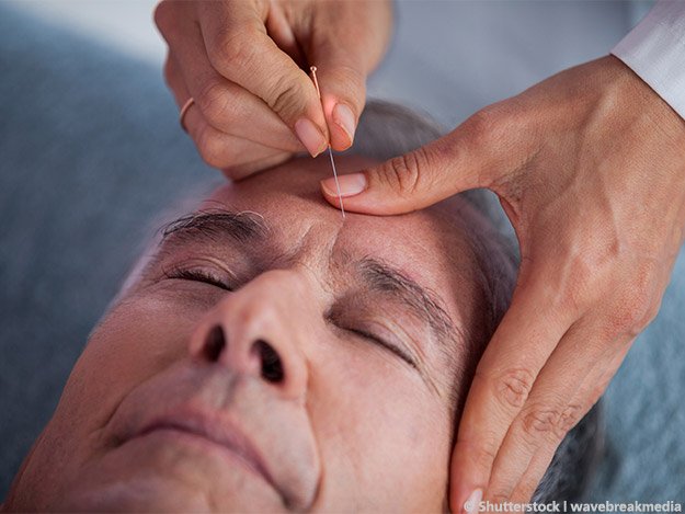 Carstens-Stiftung: Akupunktur unterstützend in der Parkinson-Therapie Carstens-Stiftung: Akupunktur unterstützend in der Parkinson-Therapie