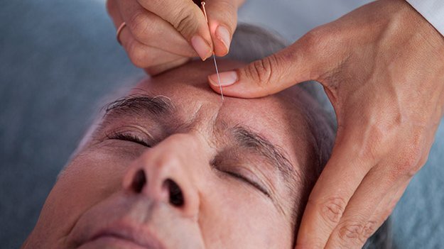 Carstens-Stiftung: Akupunktur unterstützend in der Parkinson-Therapie