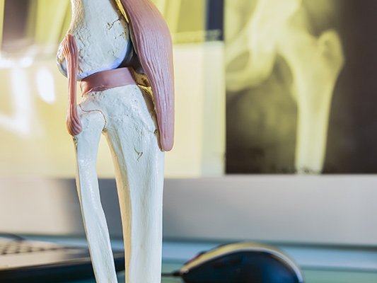 Carstens-Stiftung: Schmerz(mittel)-Reduktion nach Kniegelenksersatz mit nicht-medikamentösen Begleittherapien
