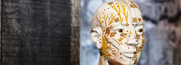 Carstens-Stiftung: Akupunktur mit Elektrostimulation zur nachhaltigen Migräneprophylaxe