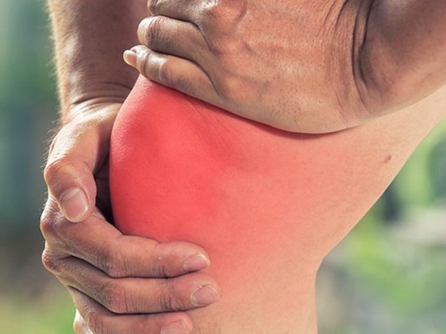 „Cooler“ Kohl: Akute Knieverletzungen heilen schneller mit Kohlwickeln plus Kälte
