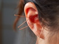 Carstens-Stiftung: Ohrakupunktur bei Schlafstörungen