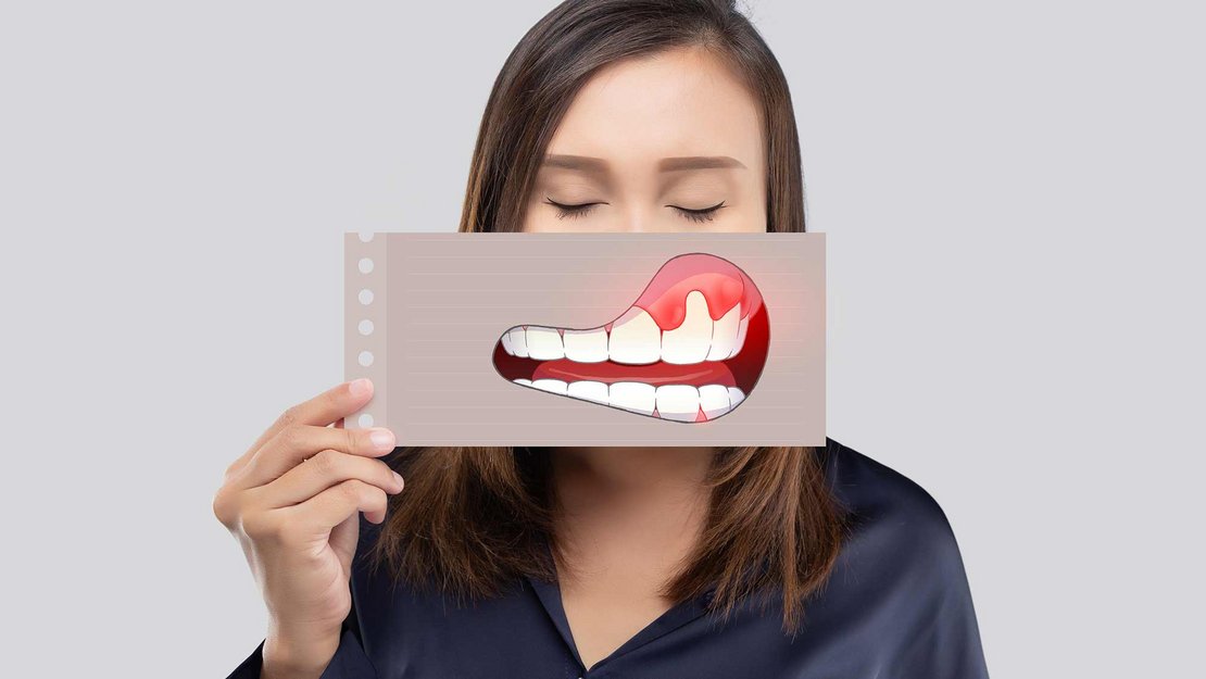 Pulpa dentis statt Wurzelkanal­behandlung?