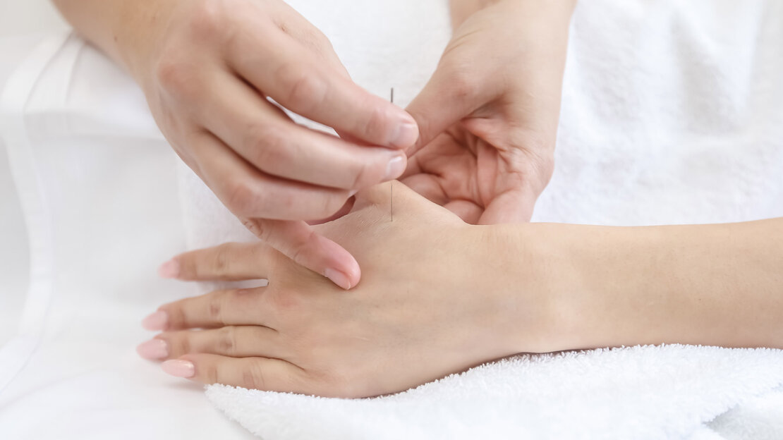 Neuropathie nach Chemotherapie: Hilft Akupunktur?