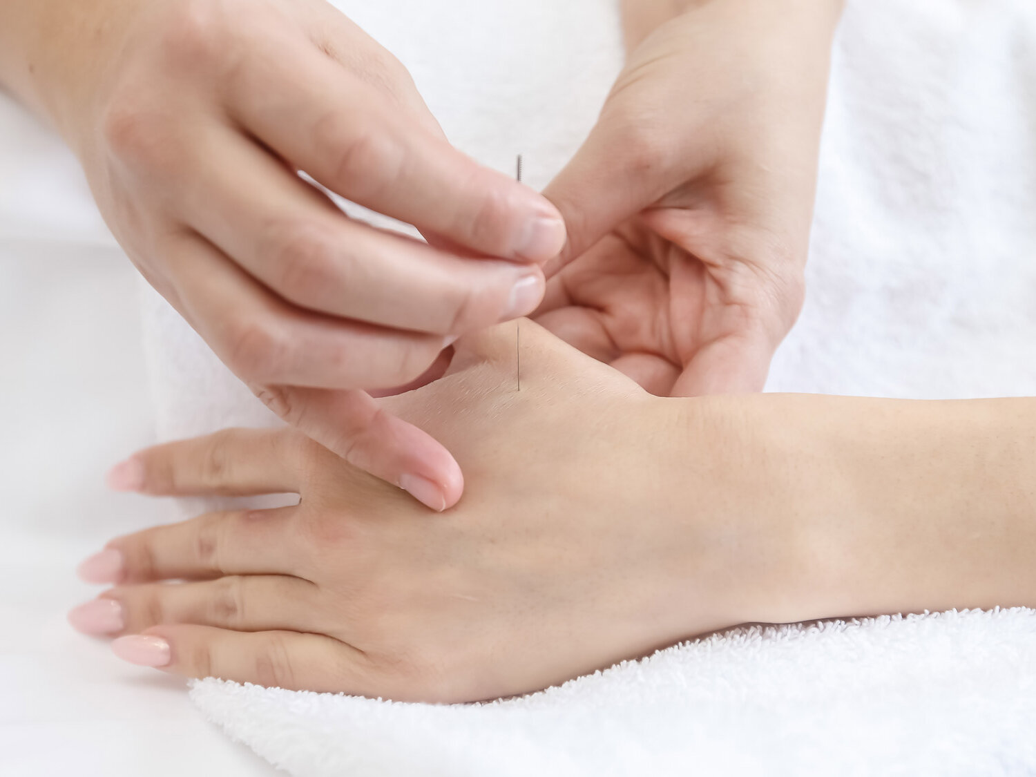 Neuropathie nach Chemotherapie: Hilft Akupunktur?