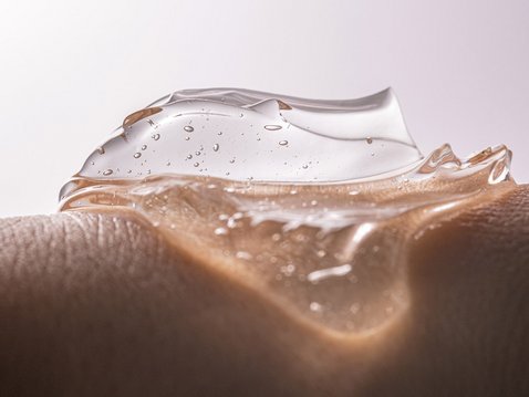 Strahlungs-Dermatitis: Prophylaxe mittels TCM-Gel?