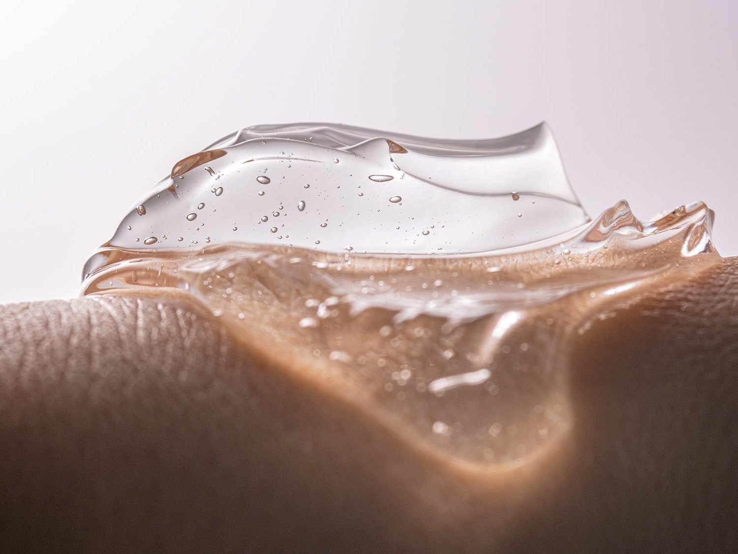 Strahlungs-Dermatitis: Prophylaxe mittels TCM-Gel?