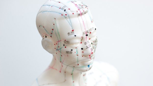 Akupunktur bei Schlaganfall: Akutbehandlung und Rehabilitation