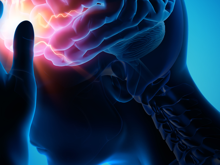 Cluster-Kopfschmerz und Migräne