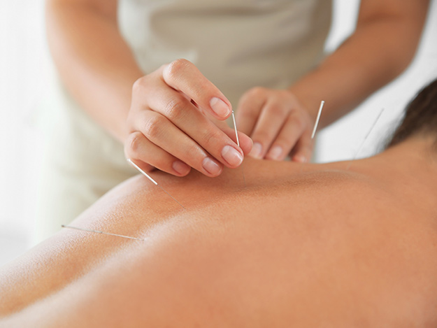 Carstens-Stiftung: Akupunktur und Massage bei krebsbedingten Schmerzen