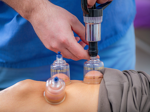 Carstens-Stiftung: Wie wirkungsvoll ist Schröpfen bei Kniearthrose?